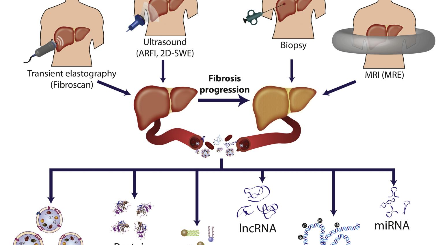 Prospects in non-invasive assessment of liver fibrosis